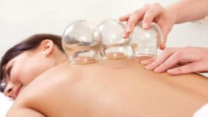 what to do with cupping